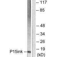 Western blot analysis of extracts from HeLa cells, using p15 INK antibody.Rabbit anti-Human CDKN2B Polyclonal Antibody