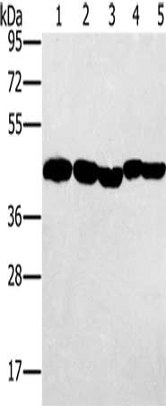 Gel: 8%SDS-PAGE, Lysate: 40 μg, Lane 1-5: Hela cells, skov3 cells, A549 cells, mouse liver tissue, human ovarian cancer tissue, Primary antibody: PON1 Antibody(PON1 Antibody) at dilution 1/500, Secondary antibody: Goat anti rabbit IgG at 1/8000 dilution, Exposure time: 20 secondsRabbit anti-Human PON1 Polyclonal Antibody