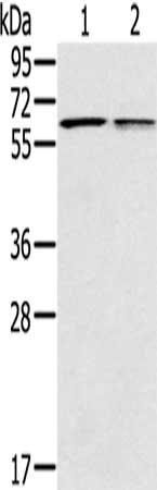 Gel: 10%SDS-PAGE, Lysate: 40 μg, Lane 1-2: Mouse liver tissue, Mouse lung tissue, Primary antibody: PTGER2 Antibody(PTGER2 Antibody) at dilution 1/200, Secondary antibody: Goat anti rabbit IgG at 1/8000 dilution, Exposure time: 10 secondsRabbit anti-Human PTGER2 Polyclonal Antibody