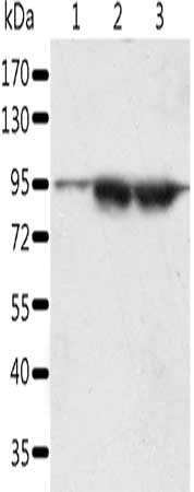 Gel: 10%SDS-PAGE, Lysate: 60 μg, Lane 1-3: A549 cells, lncap cells, human seminoma tissue, Primary antibody: SPATA20 Antibody(SPATA20 Antibody) at dilution 1/1000, Secondary antibody: Goat anti rabbit IgG at 1/8000 dilution, Exposure time: 5 minutesRabbit anti-Human SPATA20 Polyclonal Antibody