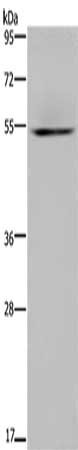 Gel: 8%SDS-PAGE, Lysate: 40 μg, Lane: Human kidney tissue, Primary antibody: HYAL3 Antibody(HYAL3 Antibody) at dilution 1/400, Secondary antibody: Goat anti rabbit IgG at 1/8000 dilution, Exposure time: 3 minutesRabbit anti-Human HYAL3 Polyclonal Antibody