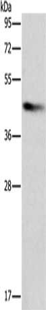 Gel: 12%SDS-PAGE, Lysate: 40 μg, Lane: Raji cells, Primary antibody: BCAT1 Antibody(BCAT1 Antibody) at dilution 1/250, Secondary antibody: Goat anti rabbit IgG at 1/8000 dilution, Exposure time: 5 secondsRabbit anti-Human BCAT1 Polyclonal Antibody