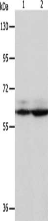 Gel: 8%SDS-PAGE, Lysate: 40 μg, Lane 1-2: Hela cells, Jurkat cells, Primary antibody: PSMD3 Antibody(PSMD3 Antibody) at dilution 1/300, Secondary antibody: Goat anti rabbit IgG at 1/8000 dilution, Exposure time: 5 secondsRabbit anti-Human PSMD3 Polyclonal Antibody