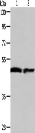 Gel: 10%SDS-PAGE, Lysate: 40 μg, Lane 1-2: Human fetal liver tissue, Human liver cancer tissue, Primary antibody: AADAC Antibody(AADAC Antibody) at dilution 1/550, Secondary antibody: Goat anti rabbit IgG at 1/8000 dilution, Exposure time: 1 minute