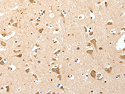 The image on the left is immunohistochemistry of paraffin-embedded Human brain tissue using S100A4 Antibody(S100A4 Antibody) at dilution 1/30, on the right is treated with synthetic peptide. (Original magnification: ×200)Rabbit anti-Human S100A4 Polyclonal Antibody