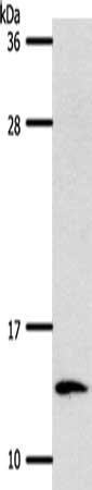 Gel: 12%SDS-PAGE, Lysate: 40 μg, Lane: Hela cells, Primary antibody: S100A4 Antibody(S100A4 Antibody) at dilution 1/500, Secondary antibody: Goat anti rabbit IgG at 1/8000 dilution, Exposure time: 40 secondsRabbit anti-Human S100A4 Polyclonal Antibody