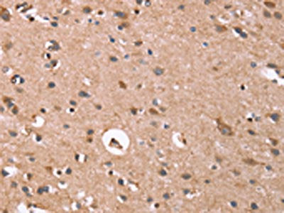 The image on the left is immunohistochemistry of paraffin-embedded Human brain  tissue using GPC6 Antibody(GPC6 Antibody) at dilution 1/40, on the right is treated with synthetic peptide. (Original magnification: ×200)Rabbit anti-Human GPC6 Polyclonal Antibody