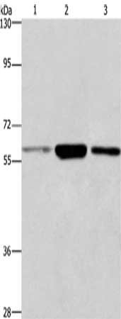 Gel: 6%SDS-PAGE, Lysate: 40 μg, Lane 1-3: K562 cells, 231 cells, human fetal liver tissue, Primary antibody: GPC6 Antibody(GPC6 Antibody) at dilution 1/750, Secondary antibody: Goat anti rabbit IgG at 1/8000 dilution, Exposure time: 1 minuteRabbit anti-Human GPC6 Polyclonal Antibody