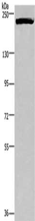 Gel: 6%SDS-PAGE, Lysate: 40 μg, Lane: MCF7 cells, Primary antibody: PRDM2 Antibody(PRDM2 Antibody) at dilution 1/200, Secondary antibody: Goat anti rabbit IgG at 1/8000 dilution, Exposure time: 1 minuteRabbit anti-Human PRDM2 Polyclonal Antibody