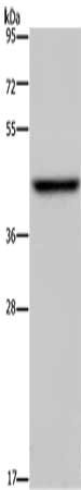 Gel: 8%SDS-PAGE, Lysate: 40 μg, Lane: Mouse liver tissue, Primary antibody: ENTPD5 Antibody(ENTPD5 Antibody) at dilution 1/500, Secondary antibody: Goat anti rabbit IgG at 1/8000 dilution, Exposure time: 5 minutesRabbit anti-Human ENTPD5 Polyclonal Antibody