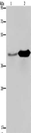 Gel: 8%SDS-PAGE, Lysate: 40 μg, Lane 1-2: Mouse liver tissue, Mouse brain tissue, Primary antibody: GLUL Antibody(GLUL Antibody) at dilution 1/650, Secondary antibody: Goat anti rabbit IgG at 1/8000 dilution, Exposure time: 10 secondsRabbit anti-Human GLUL Polyclonal Antibody