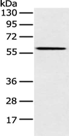 Gel: 8%SDS-PAGE, Lysate: 40 μg, Lane: K562 cell, Primary antibody: CLPTM1L Antibody(CLPTM1L Antibody) at dilution 1/200 dilution, Secondary antibody: Goat anti rabbit IgG at 1/8000 dilution, Exposure time: 30 secondsRabbit anti-Human CLPTM1L Polyclonal Antibody
