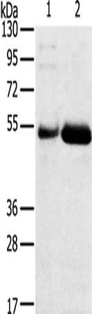 Gel: 8%SDS-PAGE, Lysate: 40 μg, Lane 1-2: Human placenta tissue, Human stomach cancer tissue, Primary antibody: SAMD3 Antibody(SAMD3 Antibody) at dilution 1/400, Secondary antibody: Goat anti rabbit IgG at 1/8000 dilution, Exposure time: 4 minutesRabbit anti-Human SAMD3 Polyclonal Antibody