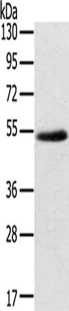 Gel: 8%SDS-PAGE, Lysate: 40 μg, Lane: Human kidney cancer tissue, Primary antibody: EDIL3 Antibody(EDIL3 Antibody) at dilution 1/250, Secondary antibody: Goat anti rabbit IgG at 1/8000 dilution, Exposure time: 2 minutesRabbit anti-Human EDIL3 Polyclonal Antibody