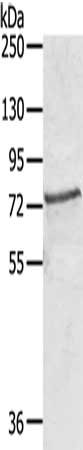 Gel: 6%SDS-PAGE, Lysate: 40 μg, Lane: Huvec cells, Primary antibody: SKIL Antibody(SKIL Antibody) at dilution 1/450, Secondary antibody: Goat anti rabbit IgG at 1/8000 dilution, Exposure time: 20 secondsRabbit anti-Human SKIL Polyclonal Antibody