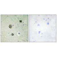 Immunohistochemistry analysis of paraffin-embedded human brain tissue using CDK5 (Ab-15) antibody.Rabbit anti-Human CDK5 Polyclonal Antibody