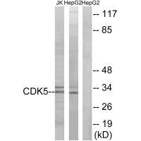 Western blot analysis of extracts from Jurkat cells and HepG2 cells, using CDK5 (Ab-15) antibody.Rabbit anti-Human CDK5 Polyclonal Antibody
