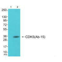 Western blot analysis of extracts from cos-7 cells (Lane 2), using CDK5 (Ab-15) antiobdy. The lane on the left is treated with synthesized peptide.Rabbit anti-Human CDK5 Polyclonal Antibody
