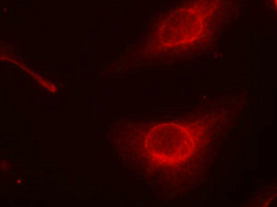 Immunofluorescence staining of methanol-fixed Hela cells using cofilin(Phospho-Ser3) Antibody.Rabbit anti-Human CFL1 Polyclonal Antibody