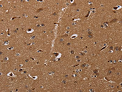 The image on the left is immunohistochemistry of paraffin-embedded Human brain  tissue using MOB1A Antibody(MOB1A Antibody) at dilution 1/30, on the right is treated with synthetic peptide. (Original magnification: ×200)Rabbit anti-Human MOB1A Polyclonal Antibody