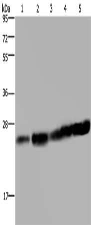 Gel: 10%SDS-PAGE, Lysate: 40 μg, Lane 1-5: Hela cells, Jurkat cells, mouse liver tissue, K562 cells, A375 cells, Primary antibody: MOB1A Antibody(MOB1A Antibody) at dilution 1/200, Secondary antibody: Goat anti rabbit IgG at 1/8000 dilution, Exposure time: 10 secondsRabbit anti-Human MOB1A Polyclonal Antibody