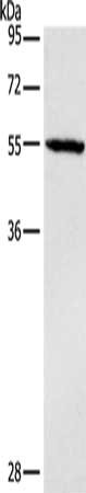 Gel: 10%SDS-PAGE, Lysate: 40 μg, Lane: Mouse heart tissue, Primary antibody: DGAT1 Antibody(DGAT1 Antibody) at dilution 1/1400, Secondary antibody: Goat anti rabbit IgG at 1/8000 dilution, Exposure time: 40 secondsRabbit anti-Human DGAT1 Polyclonal Antibody