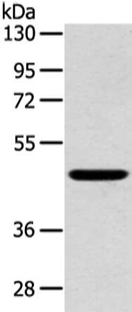 Gel: 8%SDS-PAGE, Lysate: 40 μg, Lane: Mouse kidney tissue, Primary antibody: INHBB Antibody(INHBB Antibody) at dilution 1/400 dilution, Secondary antibody: Goat anti rabbit IgG at 1/8000 dilution, Exposure time: 5 seconds
