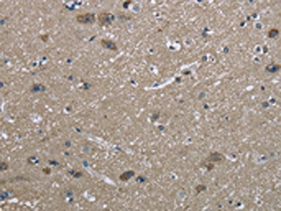 The image on the left is immunohistochemistry of paraffin-embedded Human brain  tissue using HSPA9 Antibody(HSPA9 Antibody) at dilution 1/50, on the right is treated with fusion protein. (Original magnification: ×200)Rabbit anti-Human HSPA9 Polyclonal Antibody