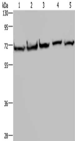 Gel: 8%SDS-PAGE, Lysate: 40 μg, Lane 1-5: HT29 cells, A549 cells, 293T cells, MCF7 cells, Hela cells, Primary antibody: HSPA9 Antibody(HSPA9 Antibody) at dilution 1/300, Secondary antibody: Goat anti rabbit IgG at 1/8000 dilution, Exposure time: 10 secondsRabbit anti-Human HSPA9 Polyclonal Antibody