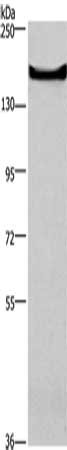 Gel: 6%SDS-PAGE, Lysate: 40 μg, Lane: Mouse bladder tissue, Primary antibody: GPR124 Antibody(GPR124 Antibody) at dilution 1/300, Secondary antibody: Goat anti rabbit IgG at 1/8000 dilution, Exposure time: 40 secondsRabbit anti-Human GPR124 Polyclonal Antibody