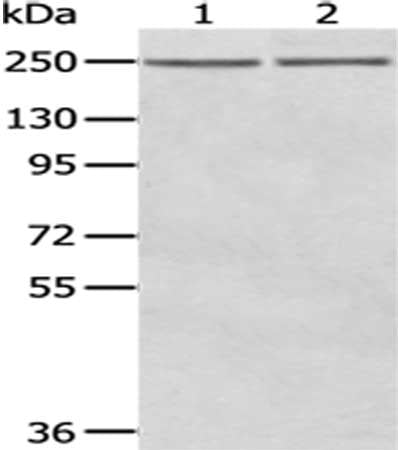 Gel: 6%SDS-PAGE,Lysate: 40 μg,Lane 1-2: A431 cells, MCF7 cells,Primary antibody: WNK2 Antibody(WNK2 Antibody) at dilution 1/200 dilution,Secondary antibody: Goat anti rabbit IgG at 1/8000 dilution,Exposure time: 3 minutesRabbit anti-Human WNK2 Polyclonal Antibody