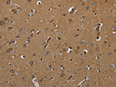 The image on the left is immunohistochemistry of paraffin-embedded Human brain  tissue using GBP5 Antibody(GBP5 Antibody) at dilution 1/50, on the right is treated with fusion protein. (Original magnification: ×200)Rabbit anti-Human GBP5 Polyclonal Antibody