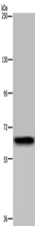 Gel: 6%SDS-PAGE, Lysate: 40 μg, Lane: Human placenta tissue, Primary antibody: GBP5 Antibody(GBP5 Antibody) at dilution 1/300, Secondary antibody: Goat anti rabbit IgG at 1/8000 dilution, Exposure time: 5 minutesRabbit anti-Human GBP5 Polyclonal Antibody
