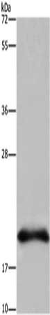 Gel: 10%SDS-PAGE, Lysate: 40 μg, Lane: U937 cells, Primary antibody: RNASE3 Antibody(RNASE3 Antibody) at dilution 1/200, Secondary antibody: Goat anti rabbit IgG at 1/8000 dilution, Exposure time: 3 minutesRabbit anti-Human RNASE3 Polyclonal Antibody