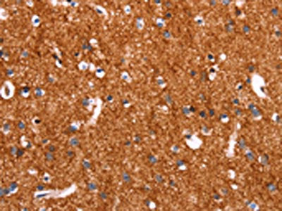 The image on the left is immunohistochemistry of paraffin-embedded Human brain tissue using the antibody Antibody) at dilution 1/20, on the right is treated with synthetic peptide. (Original magnification: ×200)Rabbit anti-Human SLC6A1 Polyclonal Antibody