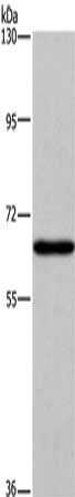 Gel: 6%SDS-PAGE, Lysate: 40 μg, Lane: HepG2 cells, Primary antibody: SLC6A1 Antibody(SLC6A1 Antibody) at dilution 1/200, Secondary antibody: Goat anti rabbit IgG at 1/8000 dilution, Exposure time: 5 minutesRabbit anti-Human SLC6A1 Polyclonal Antibody