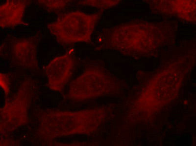 Immunofluorescence staining of methanol-fixed Hela cells using p56Dok-2(Phospho-Tyr299) Antibody.Rabbit anti-Human DOK2 Polyclonal Antibody