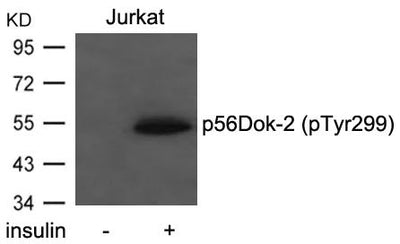 Western blot analysis of extracts from Jurkat cells  untreated or treated with insulin using p56Dok-2(Phospho-Tyr299) Antibody.Rabbit anti-Human DOK2 Polyclonal Antibody