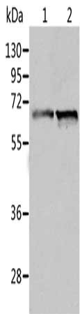 Gel: 10%SDS-PAGE, Lysate: 40 μg, Lane 1-2: Human fetal liver tissue, Human liver cancer tissue, Primary antibody: ALDH4A1 Antibody(ALDH4A1 Antibody) at dilution 1/450, Secondary antibody: Goat anti rabbit IgG at 1/8000 dilution, Exposure time: 30 secondsRabbit anti-Human ALDH4A1 Polyclonal Antibody