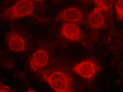 Immunofluorescence staining of methanol-fixed MCF cells using eIF4E(Phospho-Ser209) Antibody.Rabbit anti-Human EIF4E Polyclonal Antibody