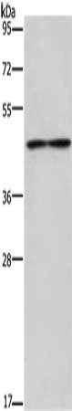 Gel: 8%SDS-PAGE, Lysate: 40 μg, Lane: Mouse heart tissue, Primary antibody: IL5RA Antibody(IL5RA Antibody) at dilution 1/550, Secondary antibody: Goat anti rabbit IgG at 1/8000 dilution, Exposure time: 3 minutesRabbit anti-Human IL5RA Polyclonal Antibody