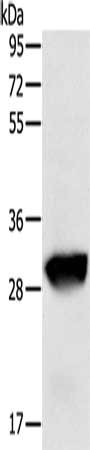 Gel: 8%SDS-PAGE, Lysate: 50 μg, Lane: Human liver cancer tissue, Primary antibody: GSTO1 Antibody(GSTO1 Antibody) at dilution 1/200, Secondary antibody: Goat anti rabbit IgG at 1/8000 dilution, Exposure time: 20 seconds