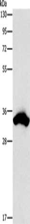 Gel: 15%SDS-PAGE, Lysate: 40 μg, Lane: 293T cells, Primary antibody: CDCA8 Antibody(CDCA8 Antibody) at dilution 1/900, Secondary antibody: Goat anti rabbit IgG at 1/8000 dilution, Exposure time: 1 secondRabbit anti-Human CDCA8 Polyclonal Antibody