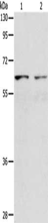Gel: 8%SDS-PAGE, Lysate: 40 μg, Lane 1-2: Human lymphoma tissue, Human testis tissue, Primary antibody: VANGL1 Antibody(VANGL1 Antibody) at dilution 1/250, Secondary antibody: Goat anti rabbit IgG at 1/8000 dilution, Exposure time: 20 secondsRabbit anti-Human VANGL1 Polyclonal Antibody