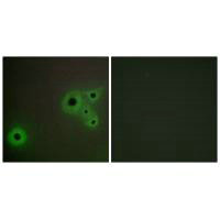 Immunofluorescence analysis of A549 cells, using MED23 antibody.