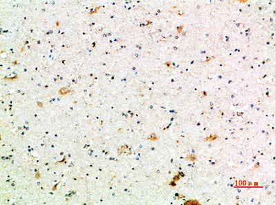 Immunohistochemical analysis of paraffin-embedded human-brain, antibody was diluted at 1:200Rabbit anti-Human FCGR1A Polyclonal Antibody