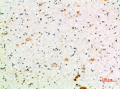 Immunohistochemical analysis of paraffin-embedded human-brain, antibody was diluted at 1:200Rabbit anti-Human FCGR1A Polyclonal Antibody