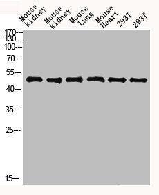 Western blot analysis of mouse-kidney lysate, antibody was diluted at 2000. Secondary antibody  was diluted at 1:20000Rabbit anti-Human FCGR1A Polyclonal Antibody
