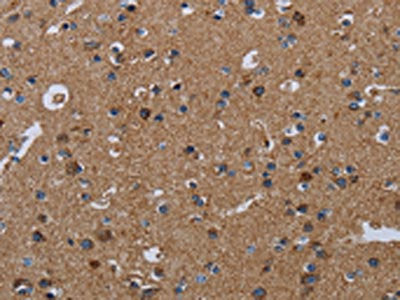 The image on the left is immunohistochemistry of paraffin-embedded Human brain  tissue using NDUFS4 Antibody(NDUFS4 Antibody) at dilution 1/20, on the right is treated with fusion protein. (Original magnification: ×200)Rabbit anti-Human NDUFS4 Polyclonal Antibody