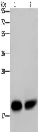 Gel: 10%SDS-PAGE, Lysate: 40 μg, Lane 1-2: Mouse kidney tissue, Mouse heart tissue, Primary antibody: NDUFS4 Antibody(NDUFS4 Antibody) at dilution 1/200, Secondary antibody: Goat anti rabbit IgG at 1/8000 dilution, Exposure time: 20 secondsRabbit anti-Human NDUFS4 Polyclonal Antibody
